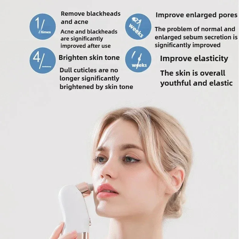 Blackhead Remover Pore Vacuum Face Cleaner Electric Pimple Acne Black Head Removal USB Rechargeable Water Cycle Black Dot Remove